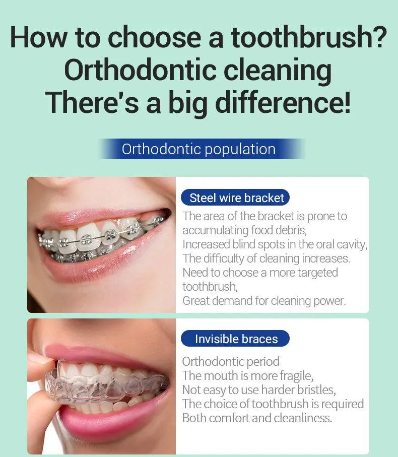 Orthodontic Toothbrush Set