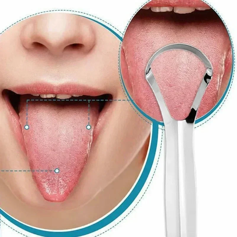 Stainless Steel Tongue Scraper